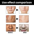 Facial Melanin Repair Hydrating Skincare Products