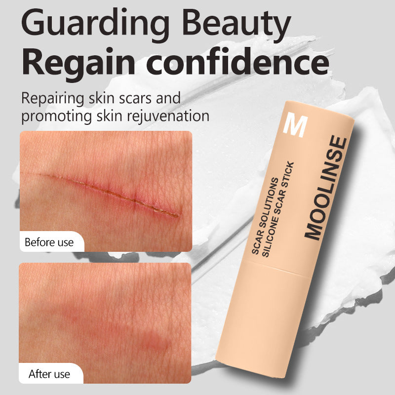 Silicone Scar Care Stick Nourishing And Gentle Skin Care
