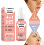Advence Skin Care 4 In 1 FACIAL SERUM